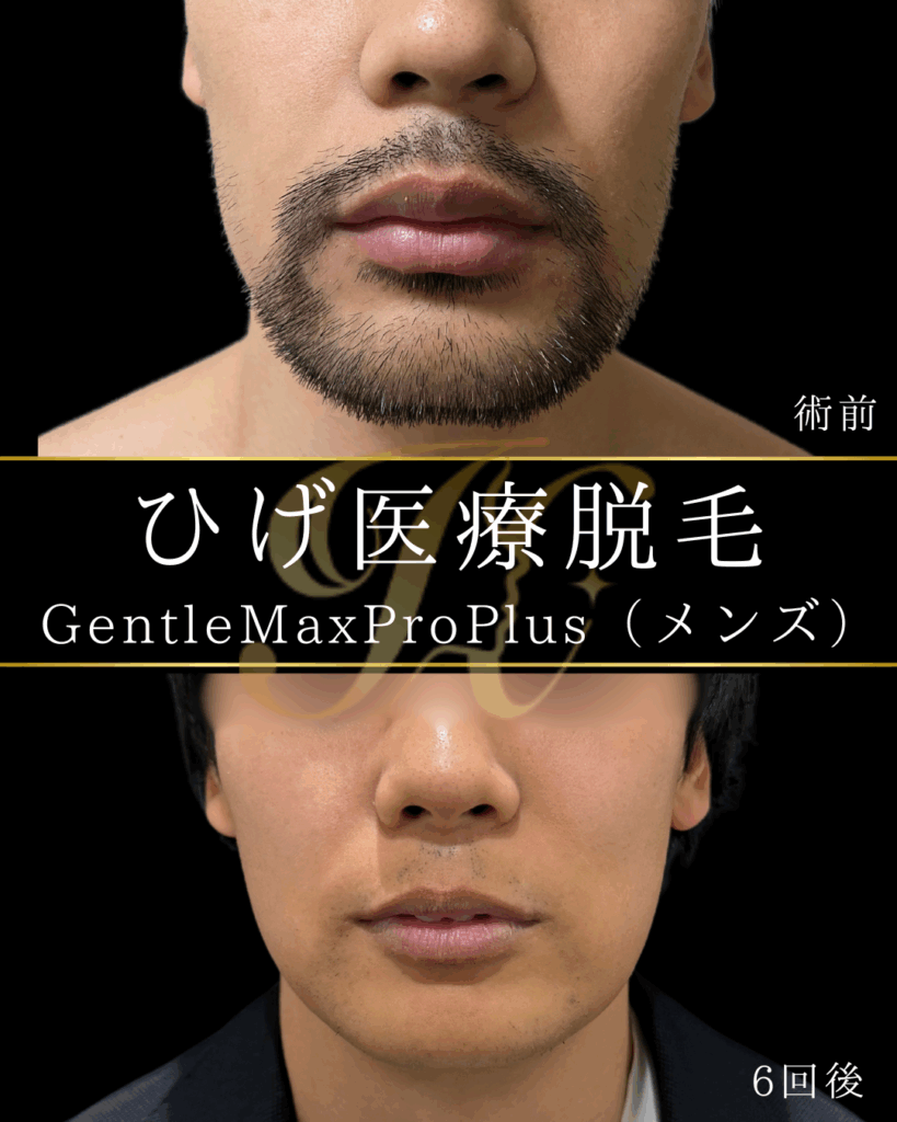 症例イメージ