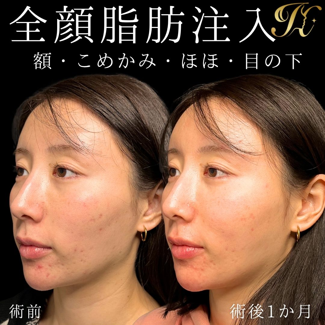 症例イメージ