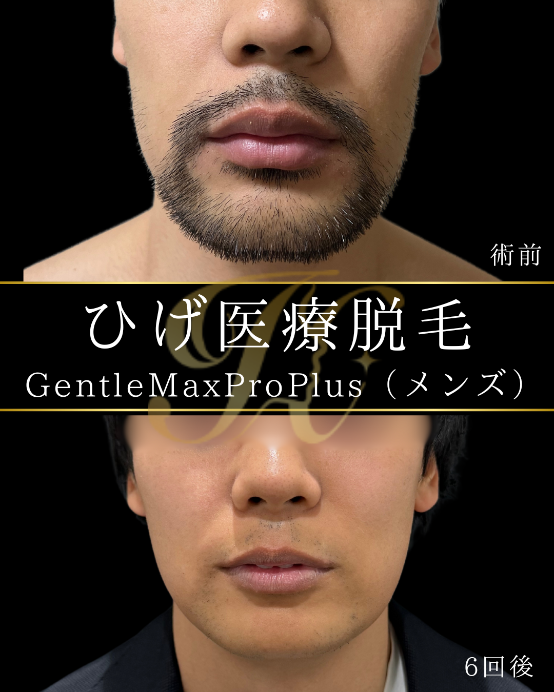 症例イメージ