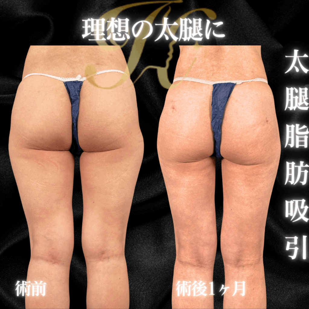 症例イメージ