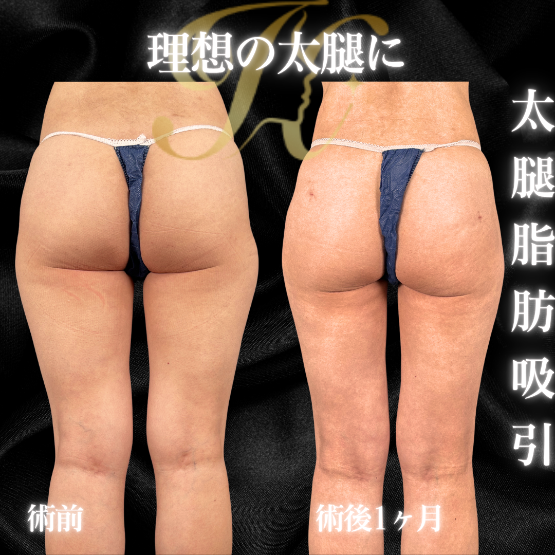 症例イメージ