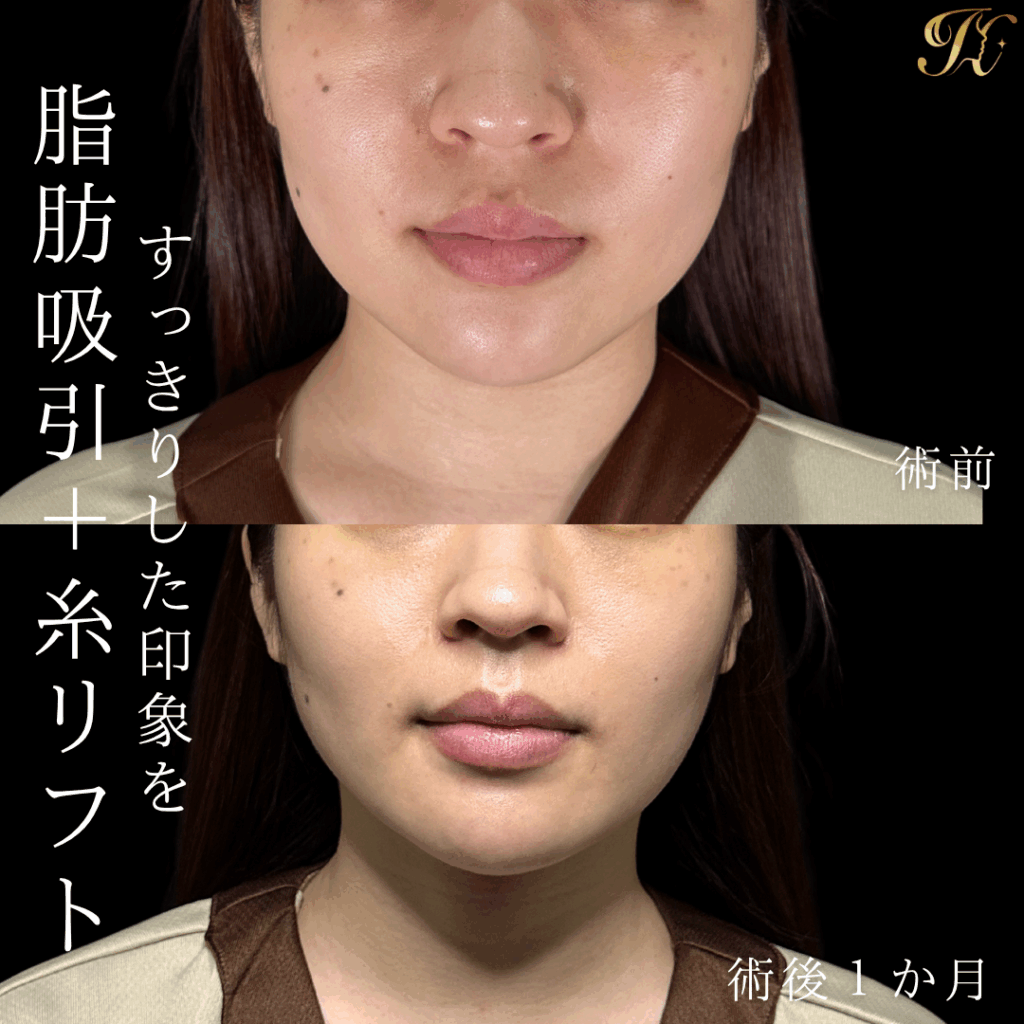 症例イメージ