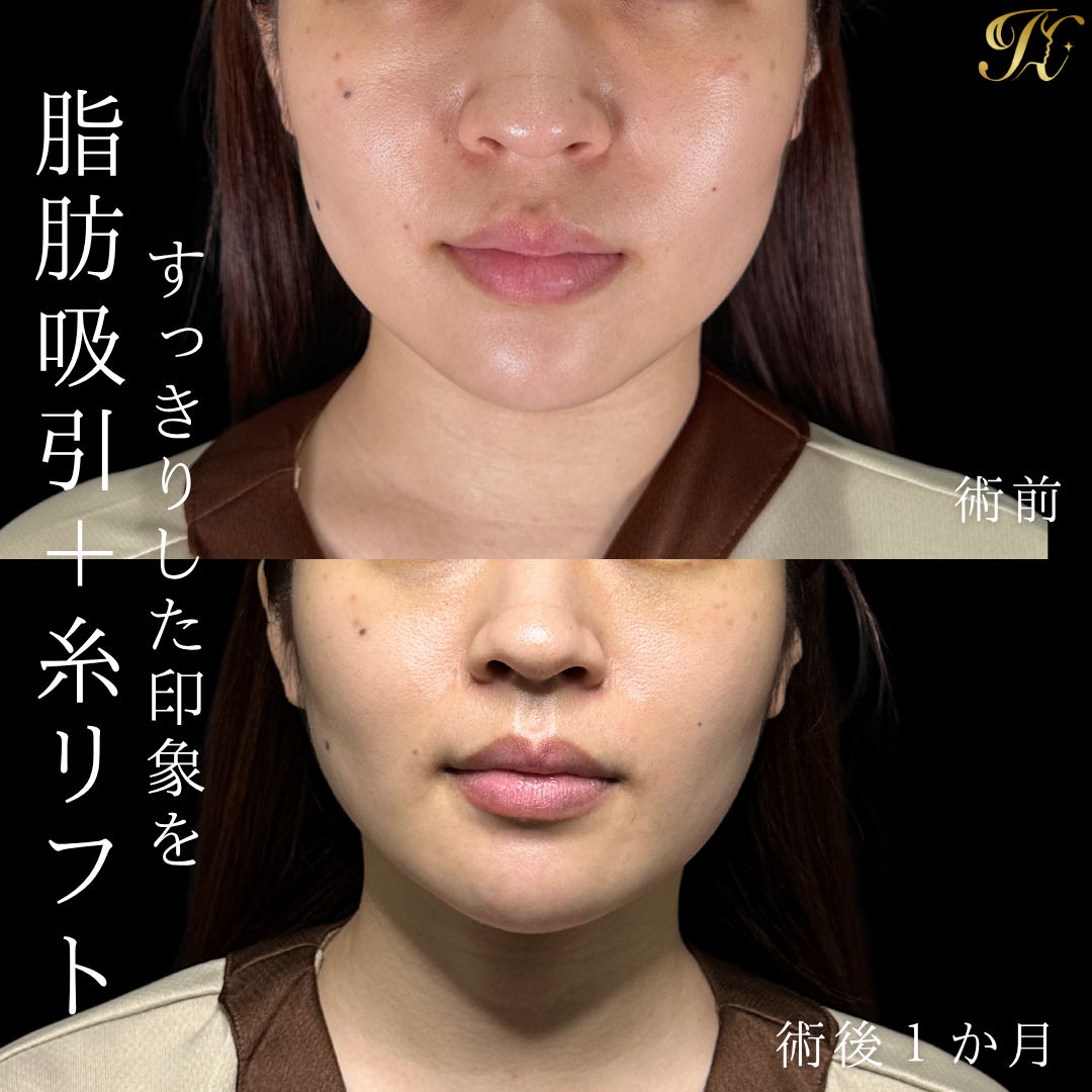 症例イメージ