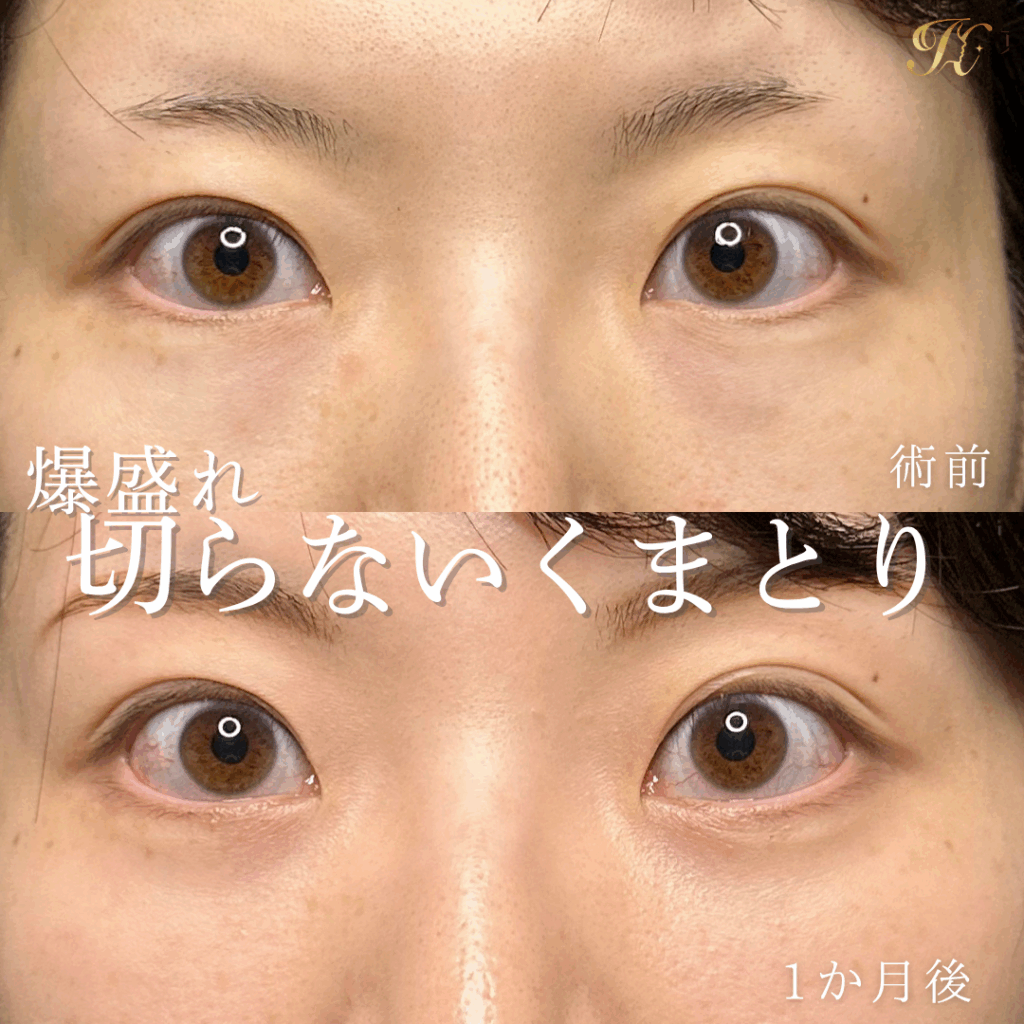 症例イメージ