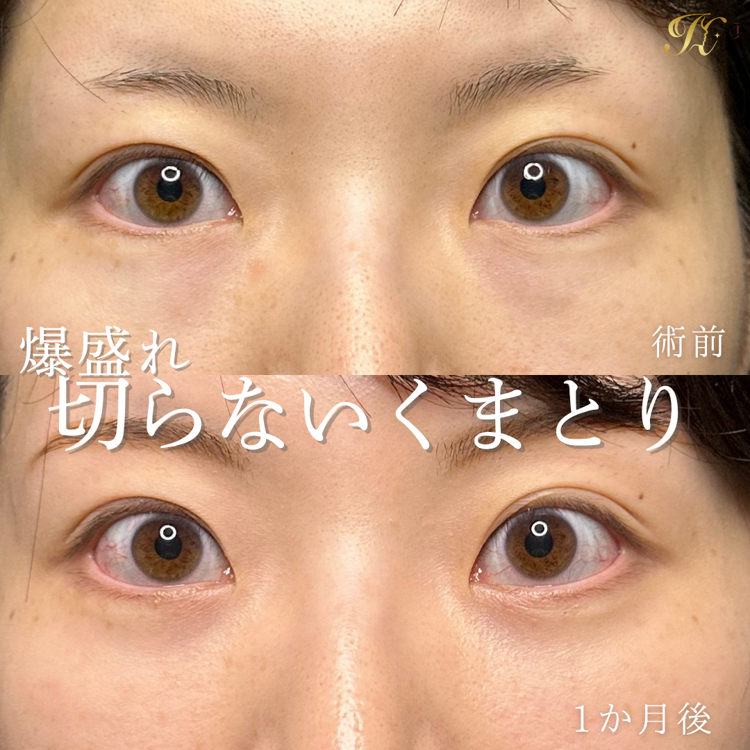 症例イメージ
