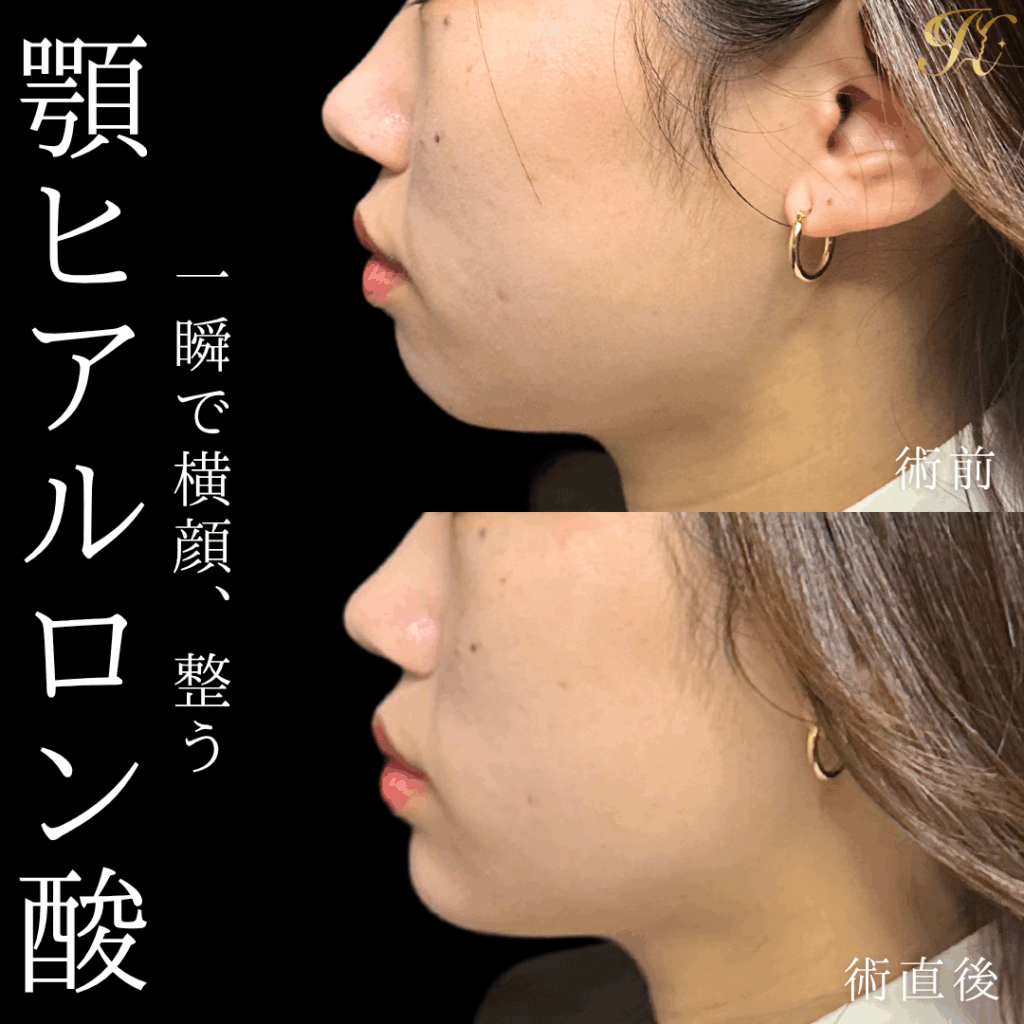 症例イメージ