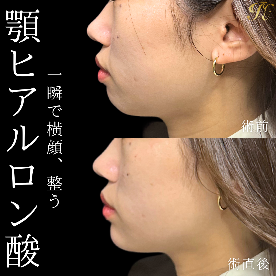 症例イメージ