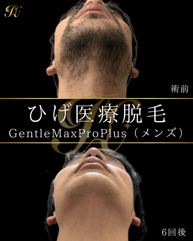 症例イメージ