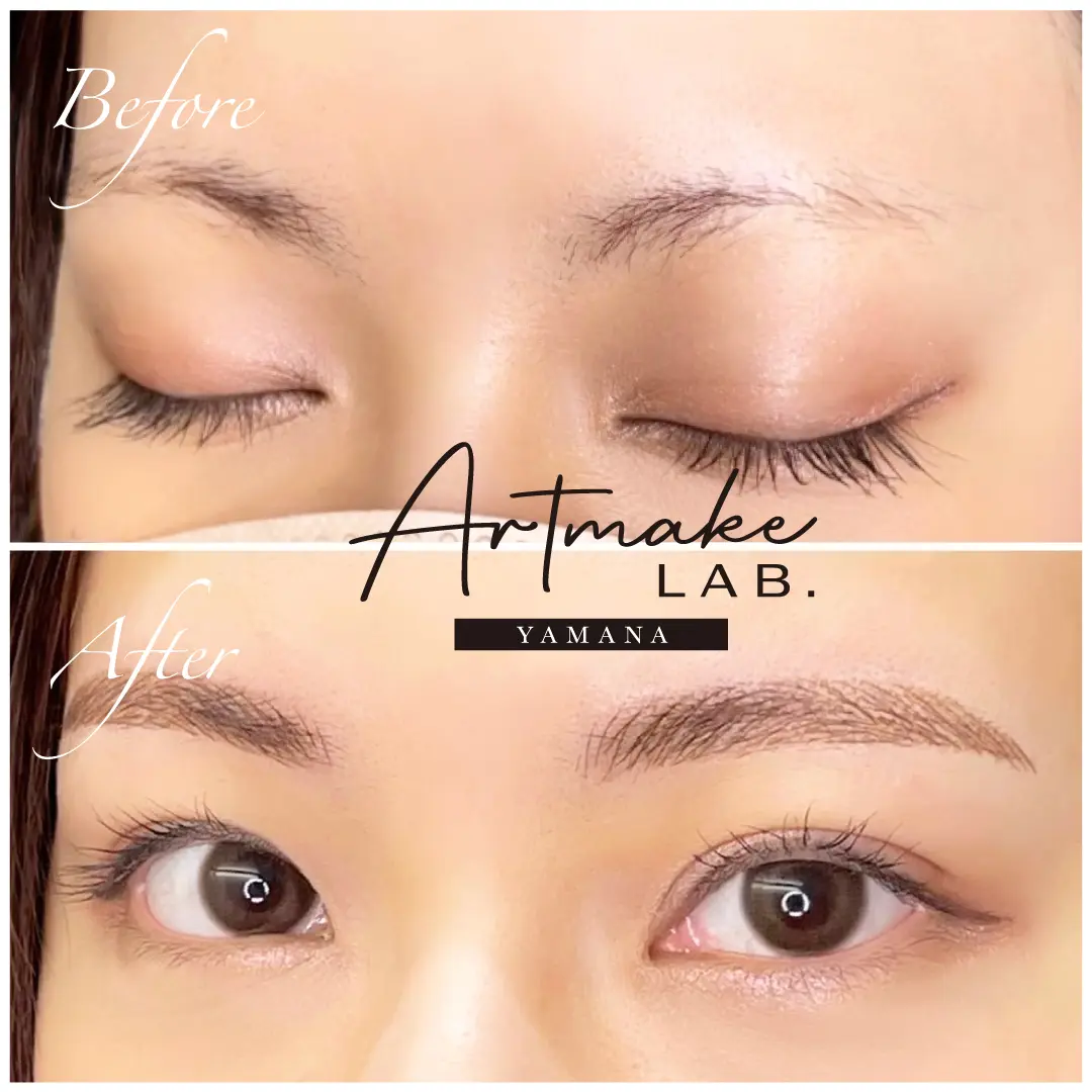 Artmake Lab症例写真