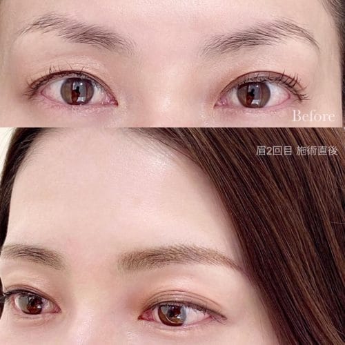 Do’contour(ドゥ コントア)恵比寿院アートメイク症例写真