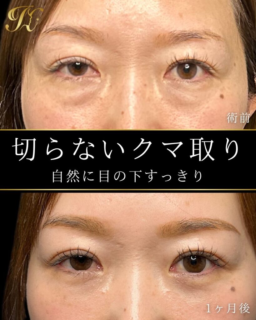 症例イメージ