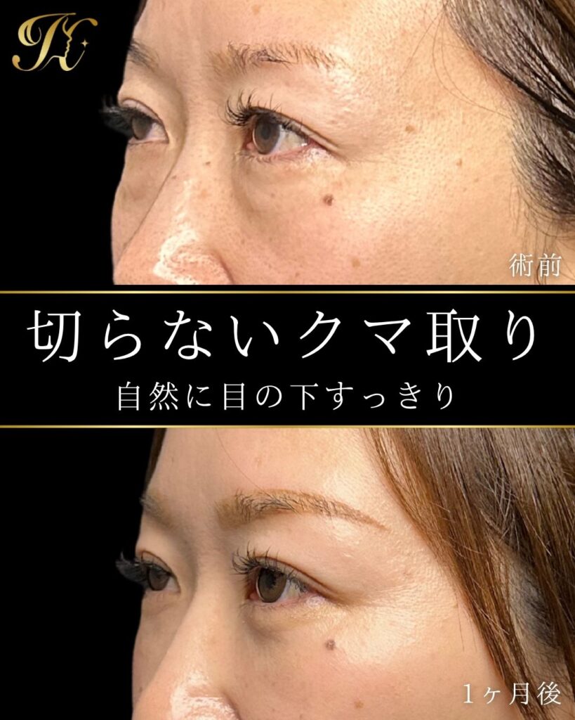 症例イメージ