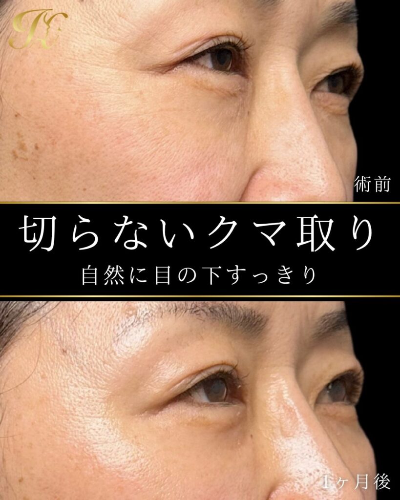 症例イメージ