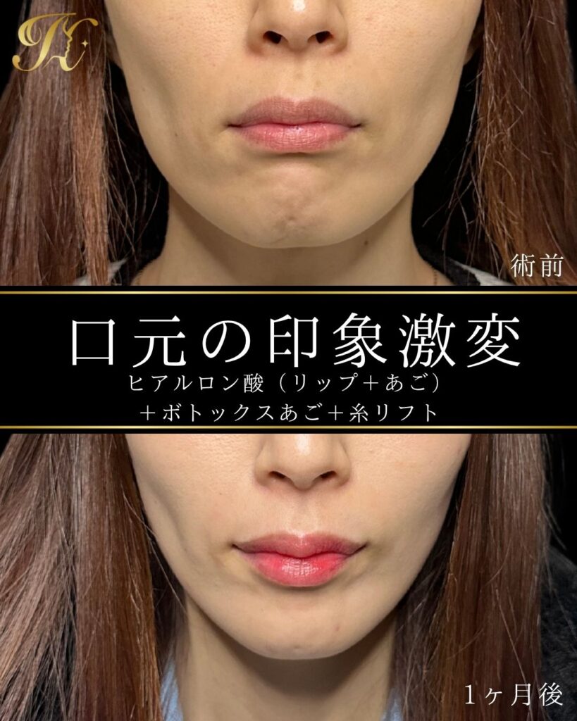 症例イメージ