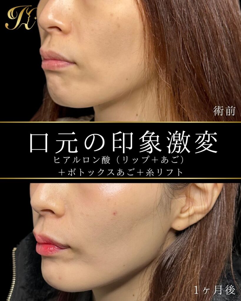 症例イメージ