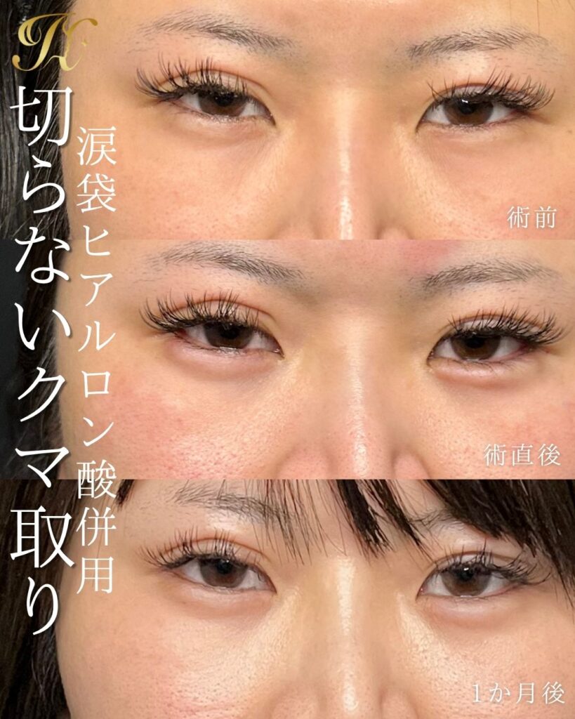 症例イメージ