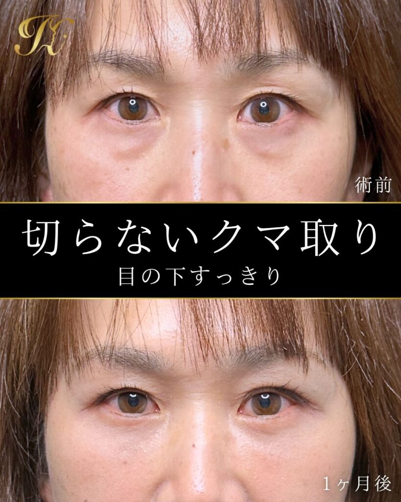 症例イメージ