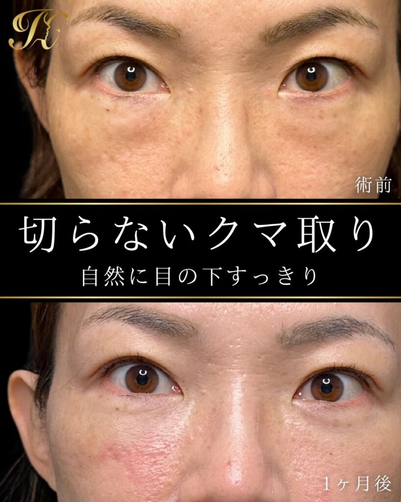 症例イメージ