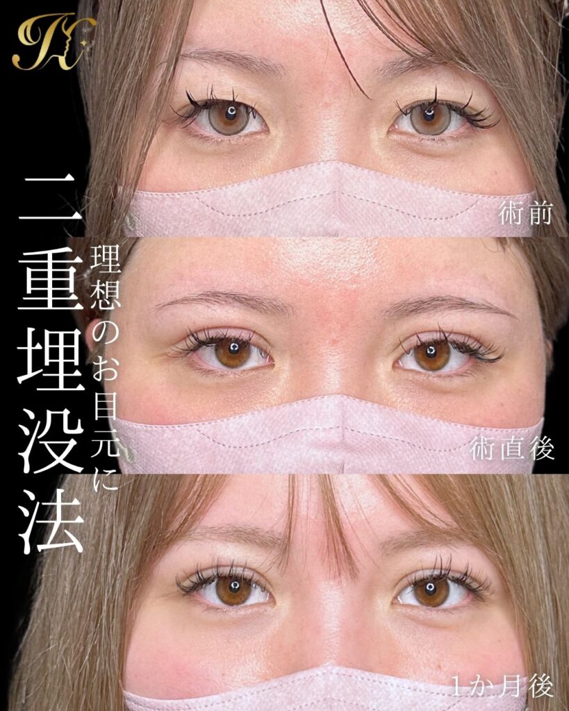 症例イメージ