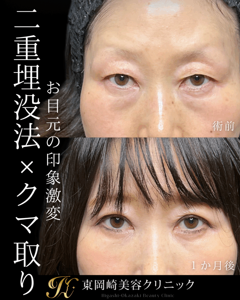 症例イメージ