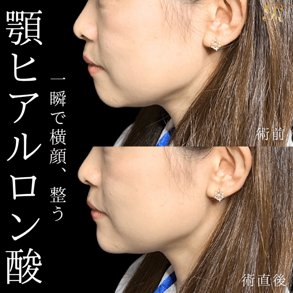 症例イメージ