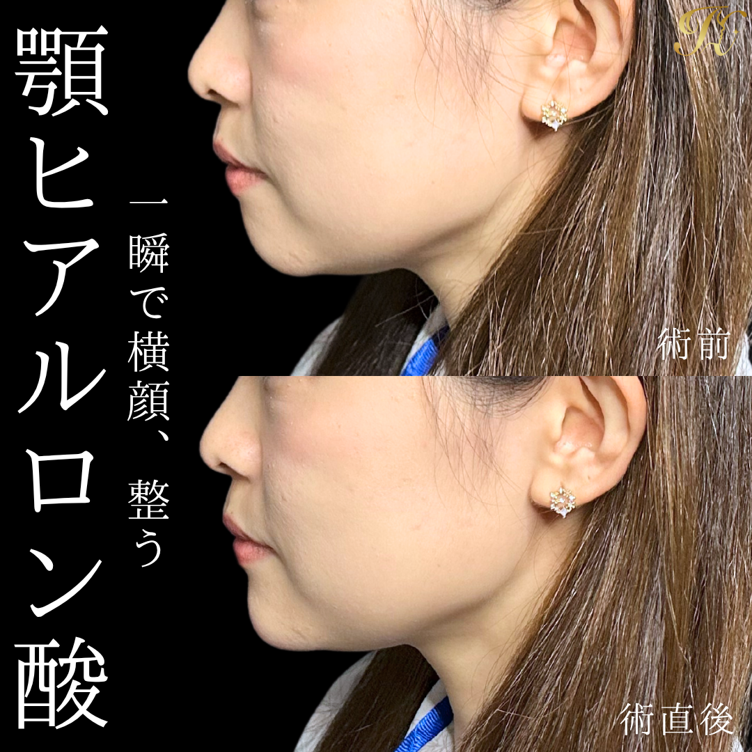 症例イメージ