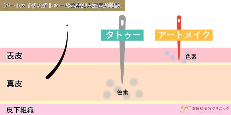 アートメイクとタトゥーの色素注入深度の比較