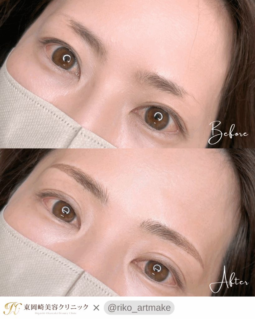 アートメイク症例平行アーチ眉