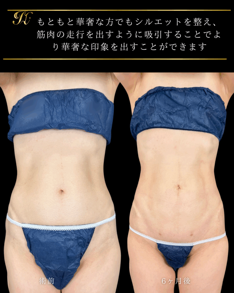 症例イメージ