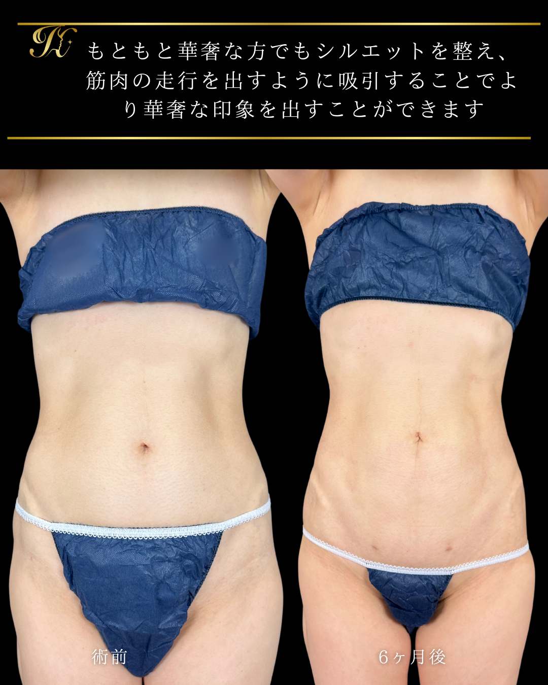 症例イメージ
