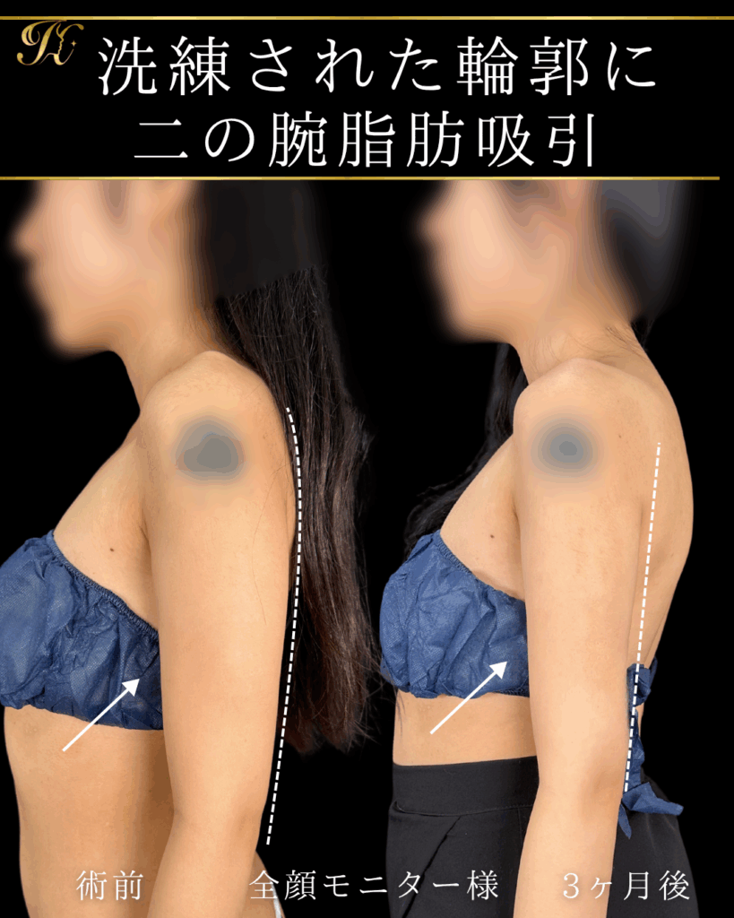 症例イメージ
