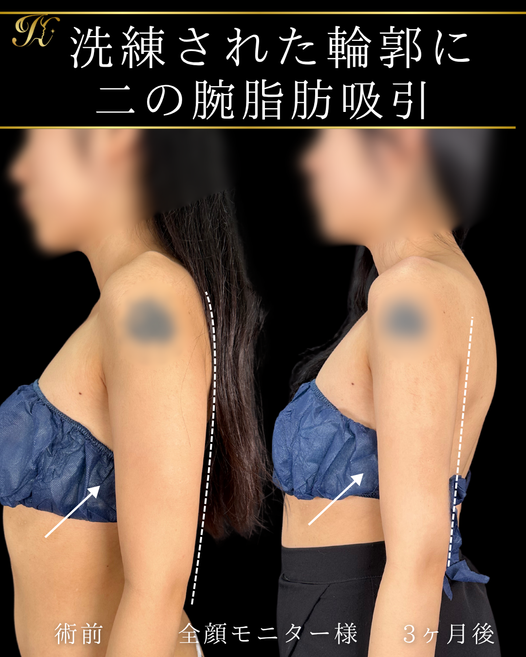症例イメージ