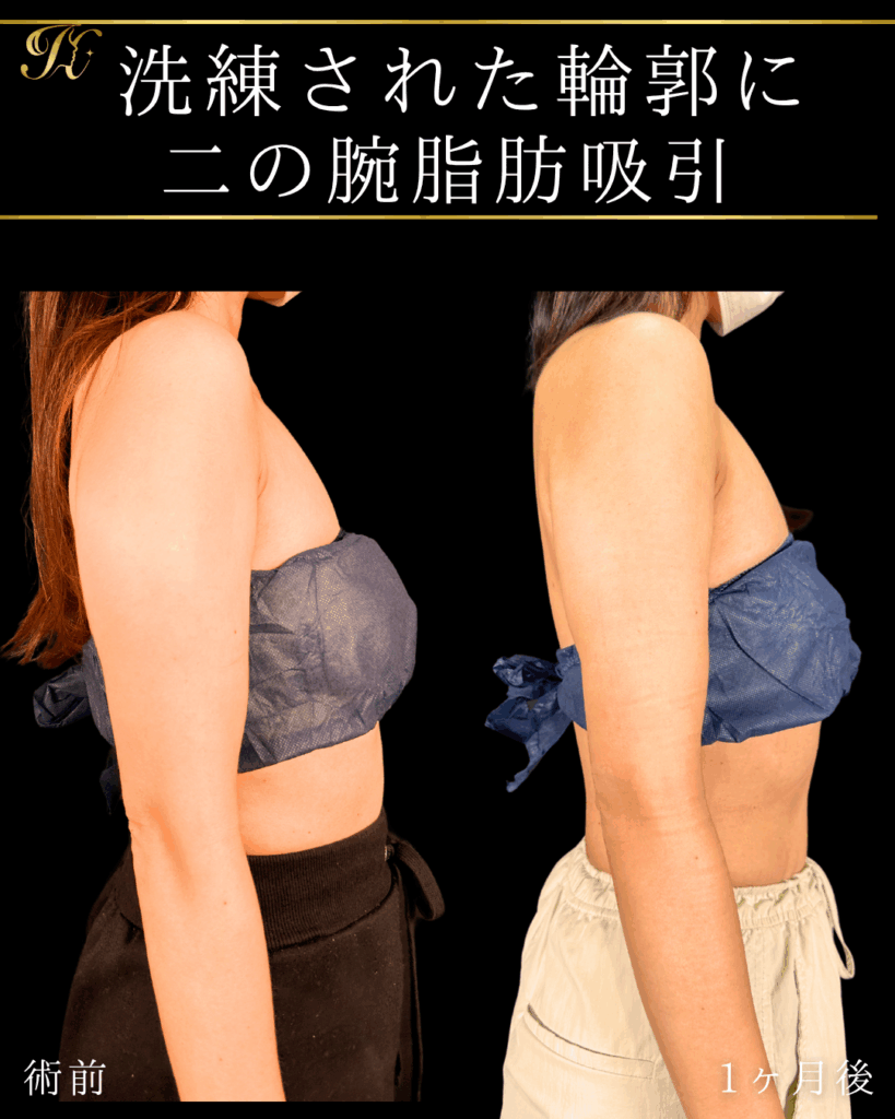 症例イメージ