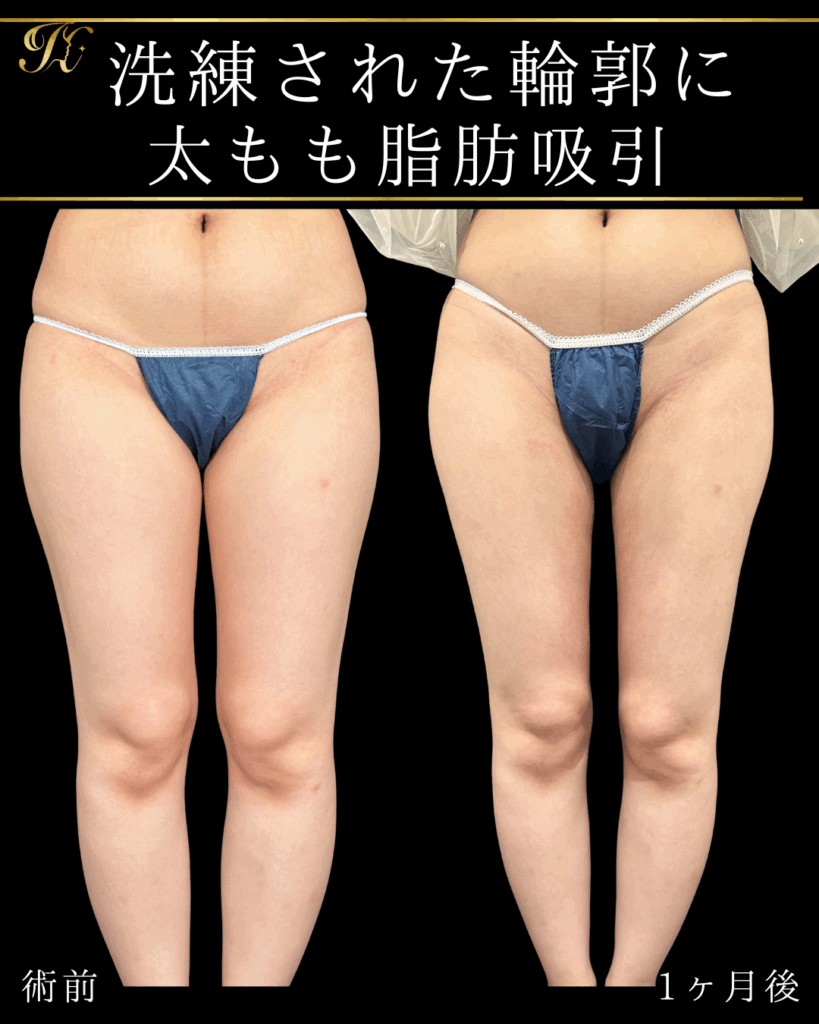 症例イメージ