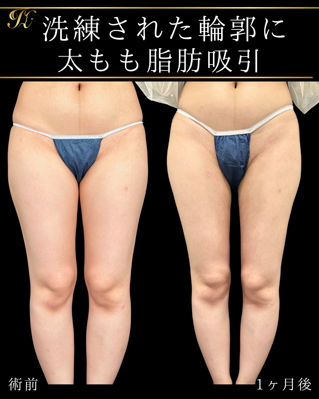 症例イメージ