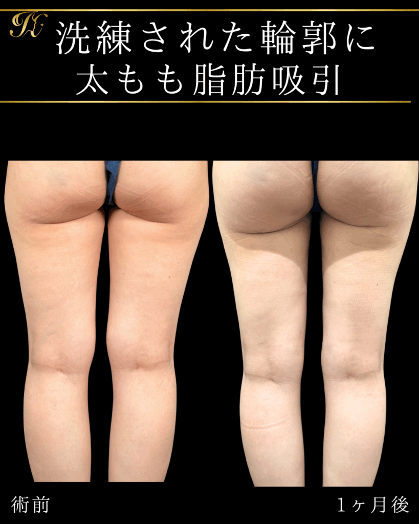 症例イメージ