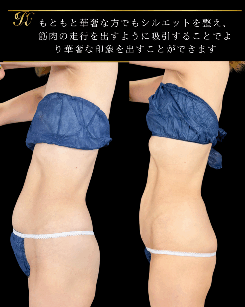 症例イメージ
