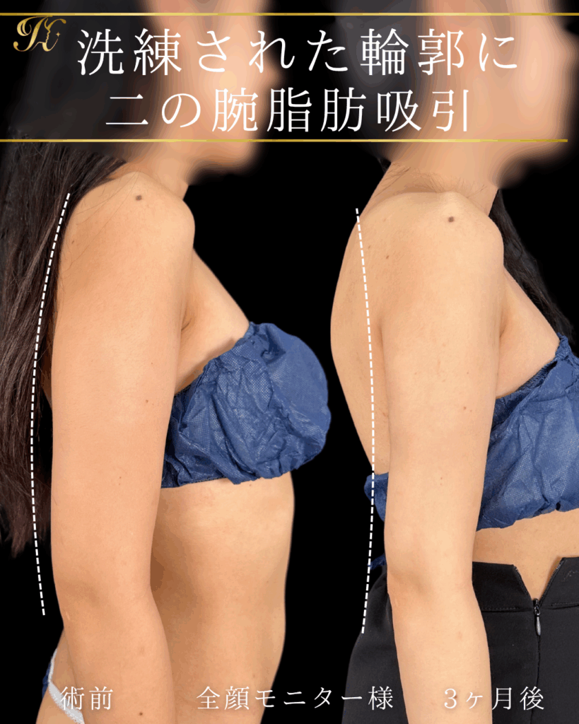 症例イメージ