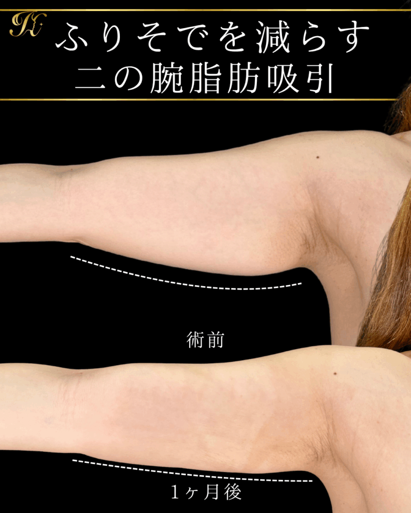 症例イメージ
