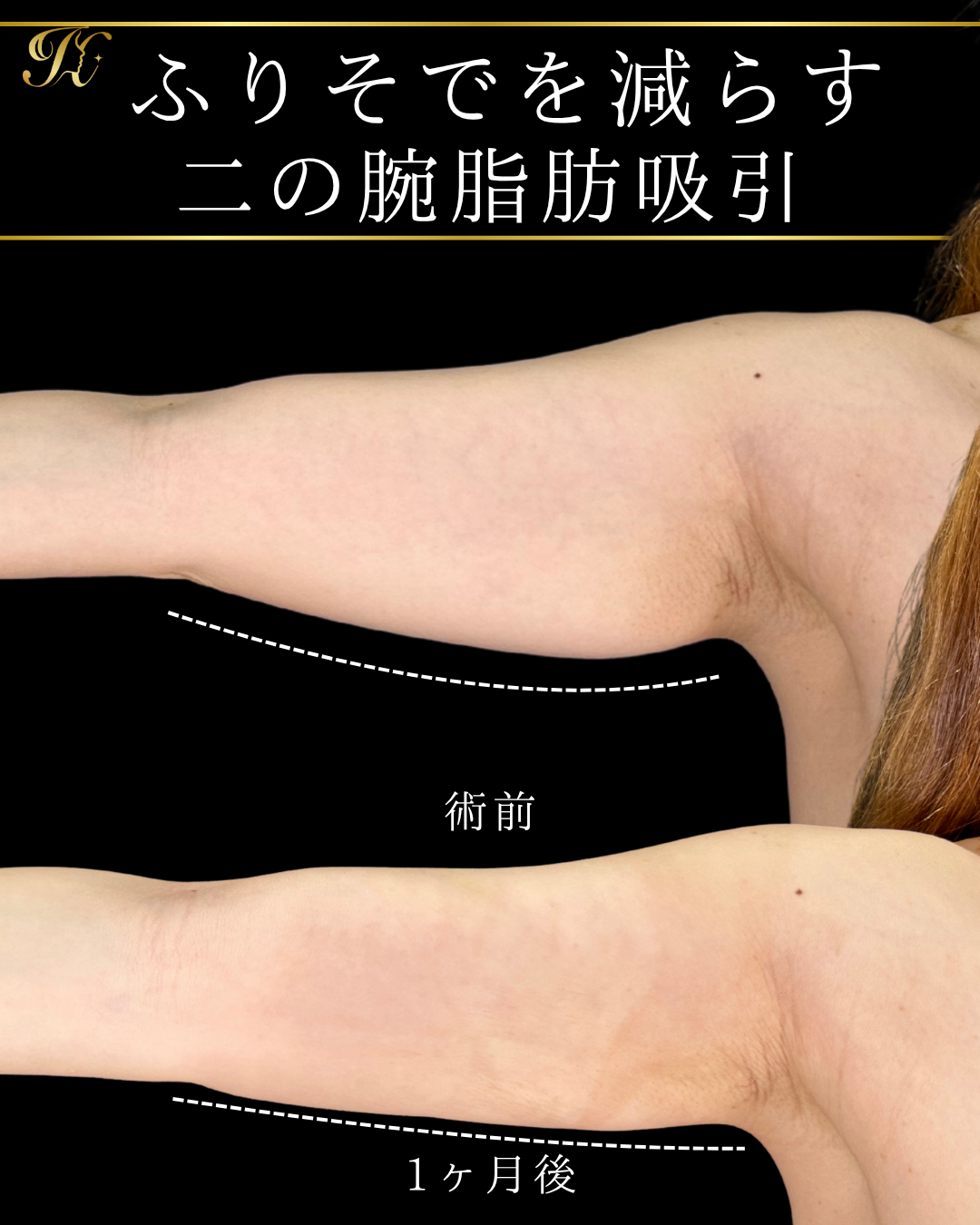 症例イメージ
