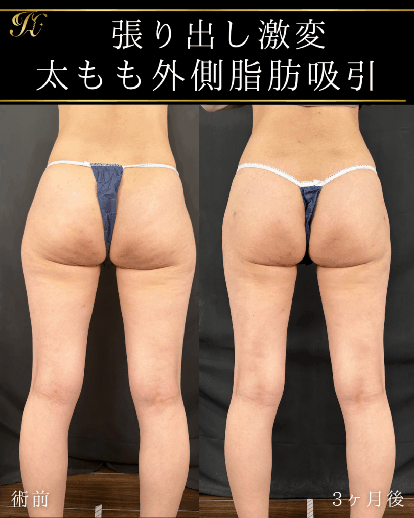 症例イメージ