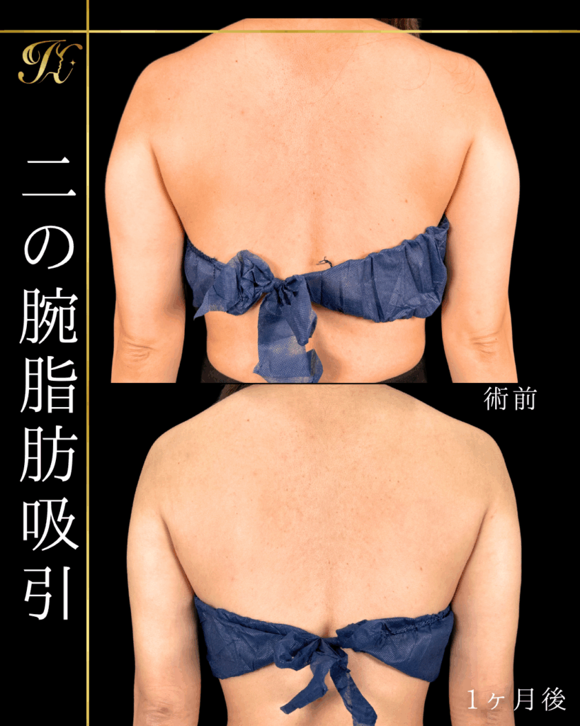 症例イメージ