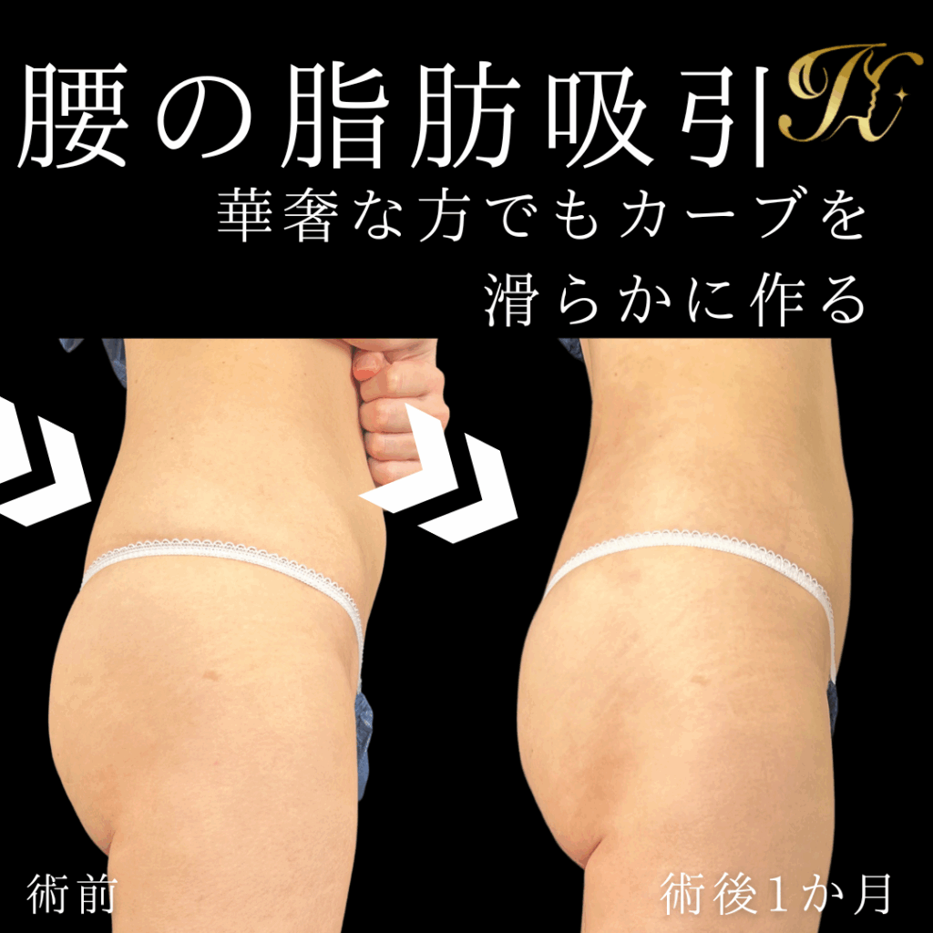 症例イメージ