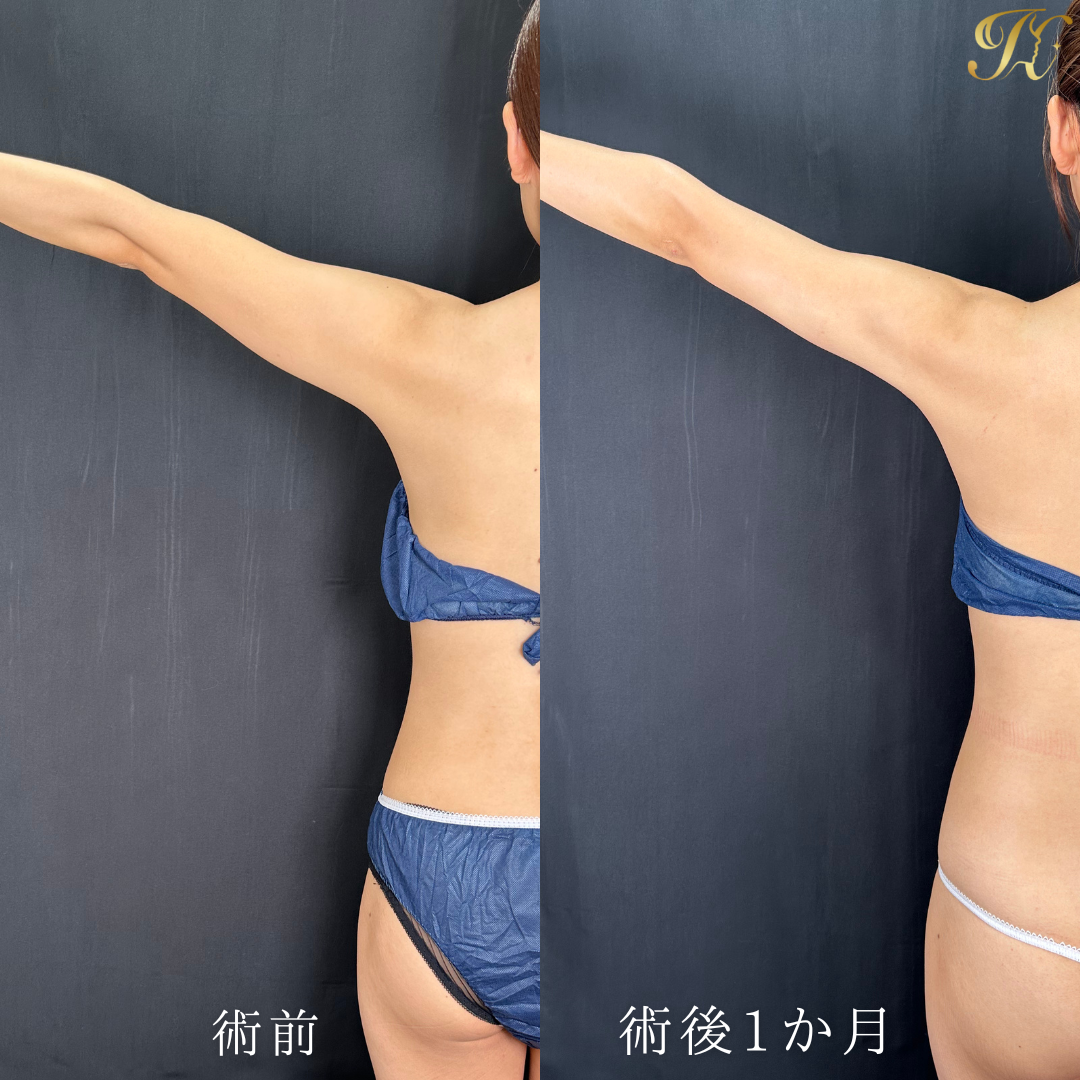 症例イメージ