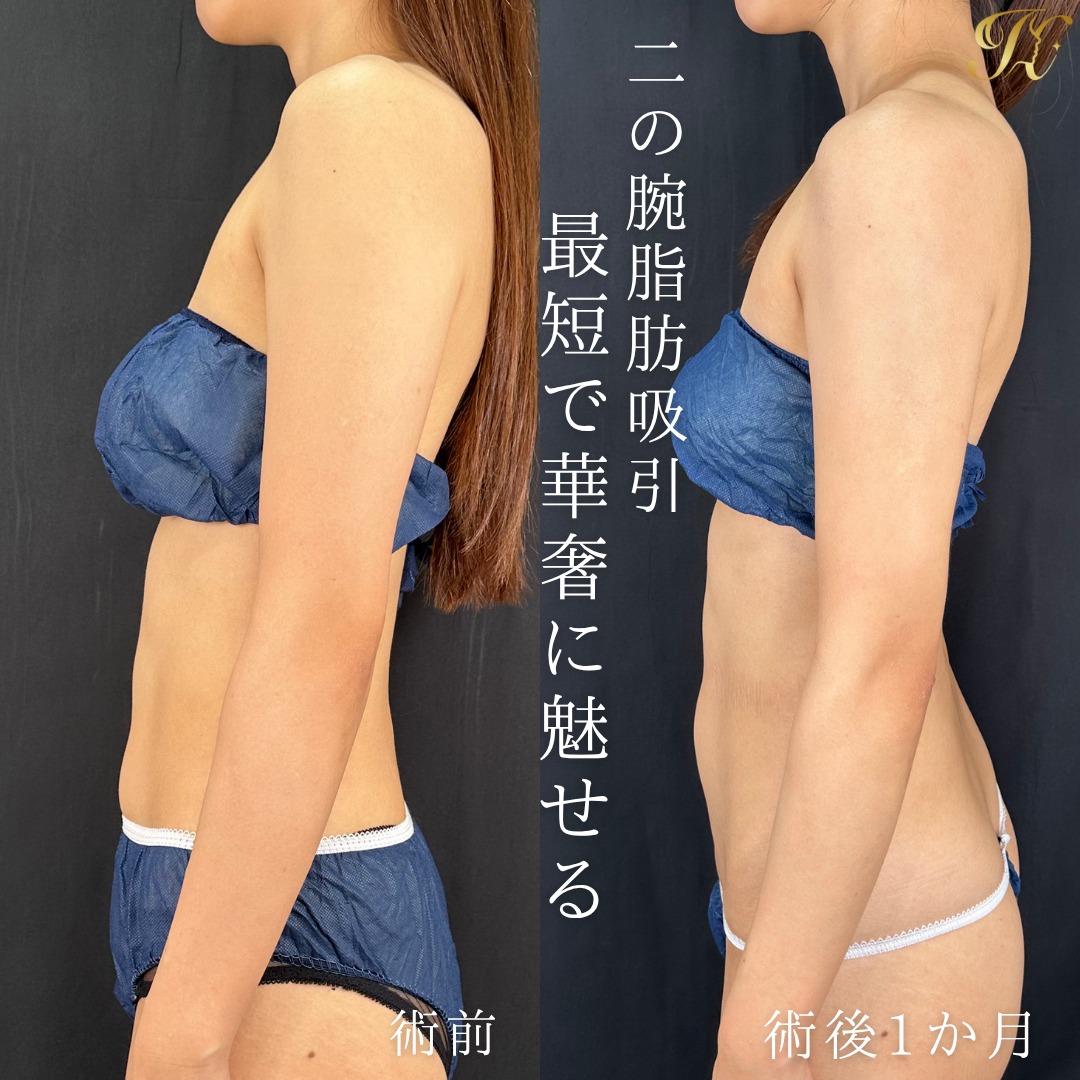症例イメージ