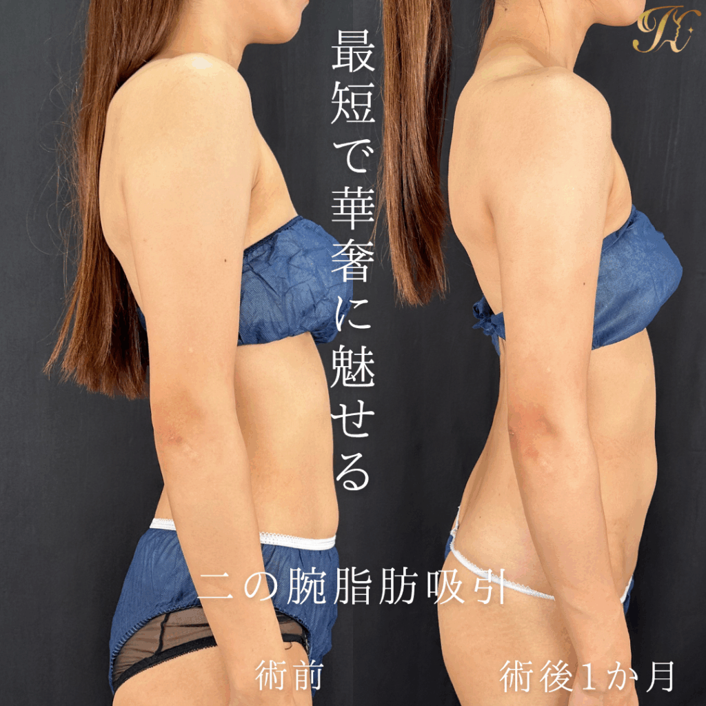 症例イメージ