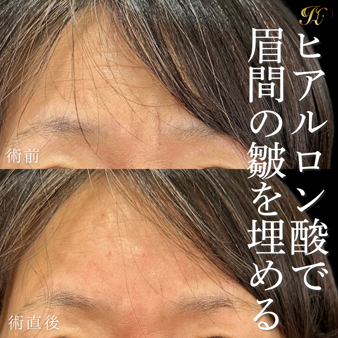 症例イメージ