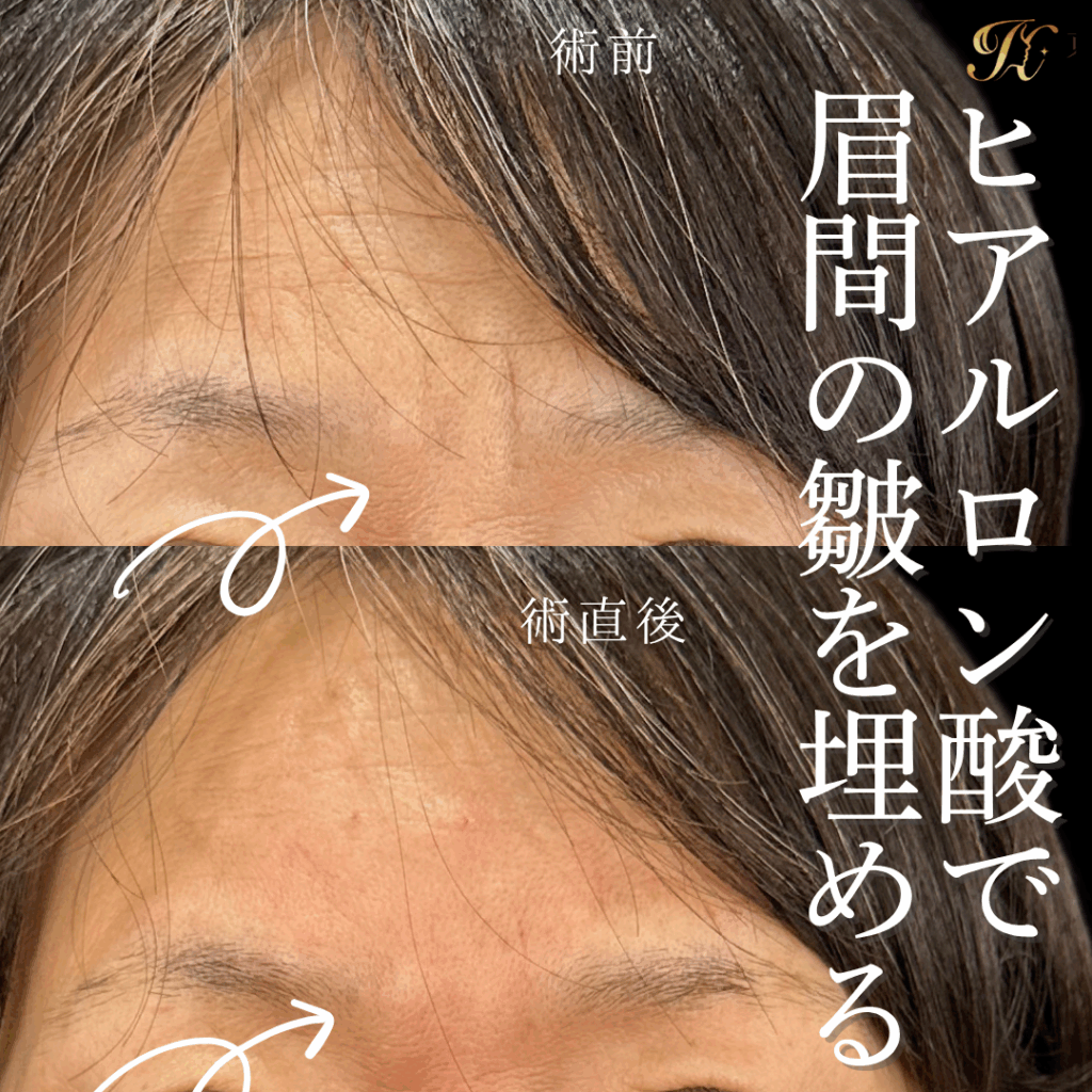 症例イメージ