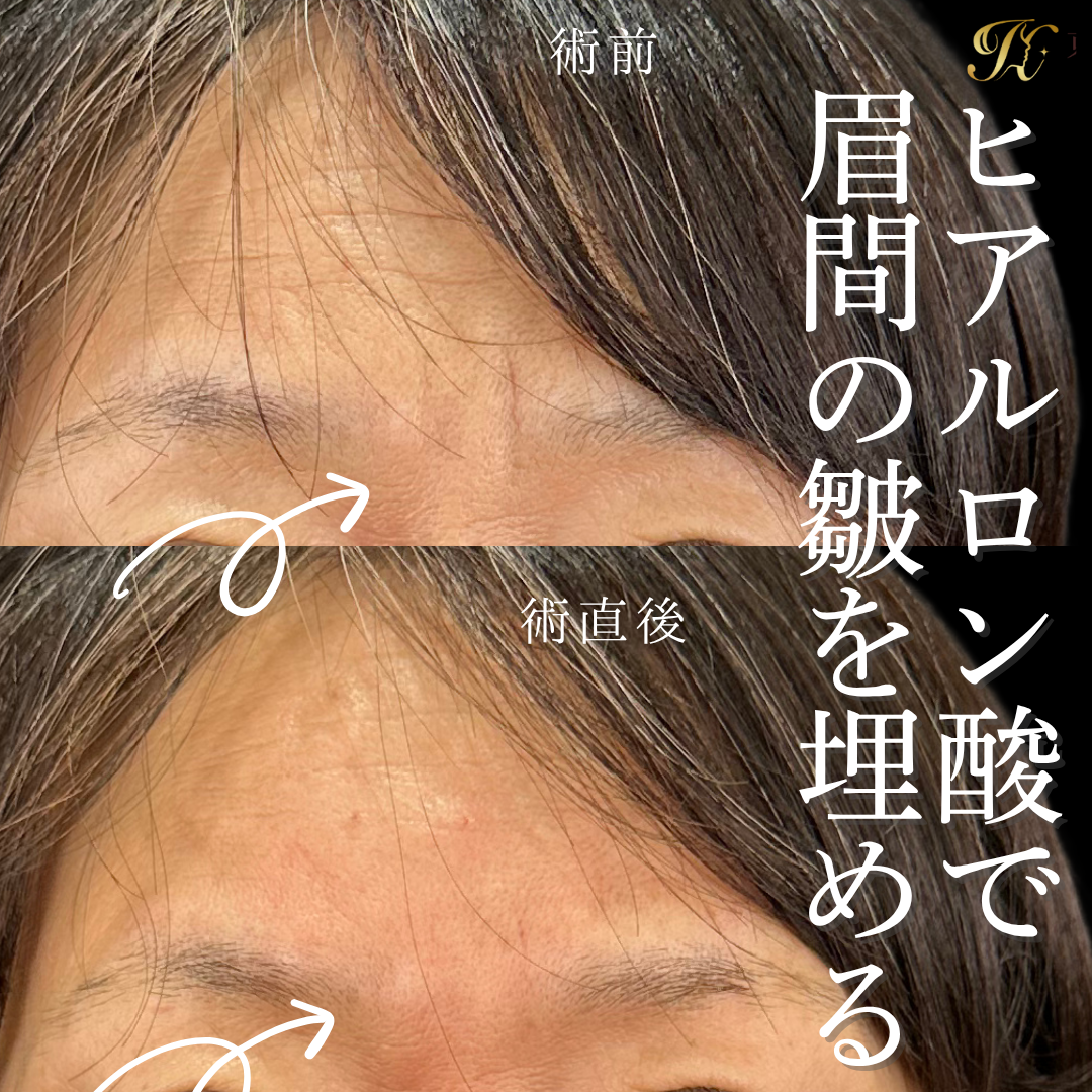 症例イメージ