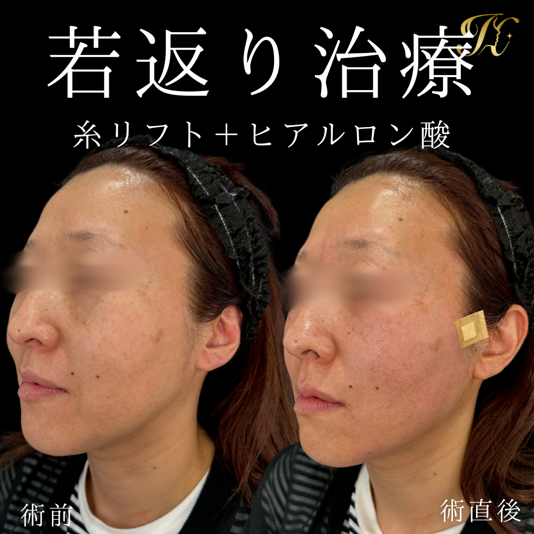 症例イメージ